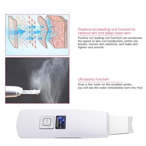 Ultrasonic Face Cleanser Blackhead Acne Removal Facial Spa