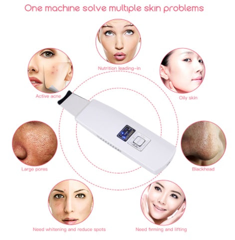 Ultrasonic Face Cleanser Blackhead Acne Removal Facial Spa