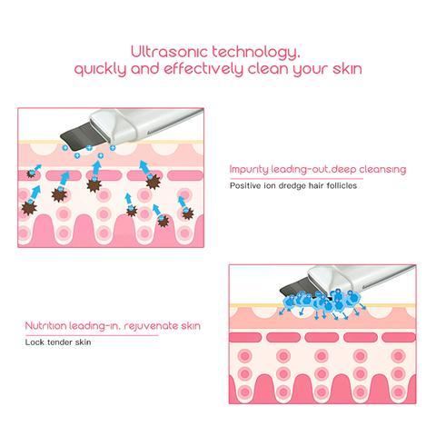 Ultrasonic Face Cleanser Blackhead Acne Removal Facial Spa