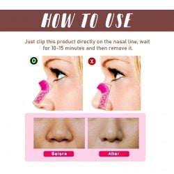 Nose Shaping And Correction Nose Contour  Nose Bridge