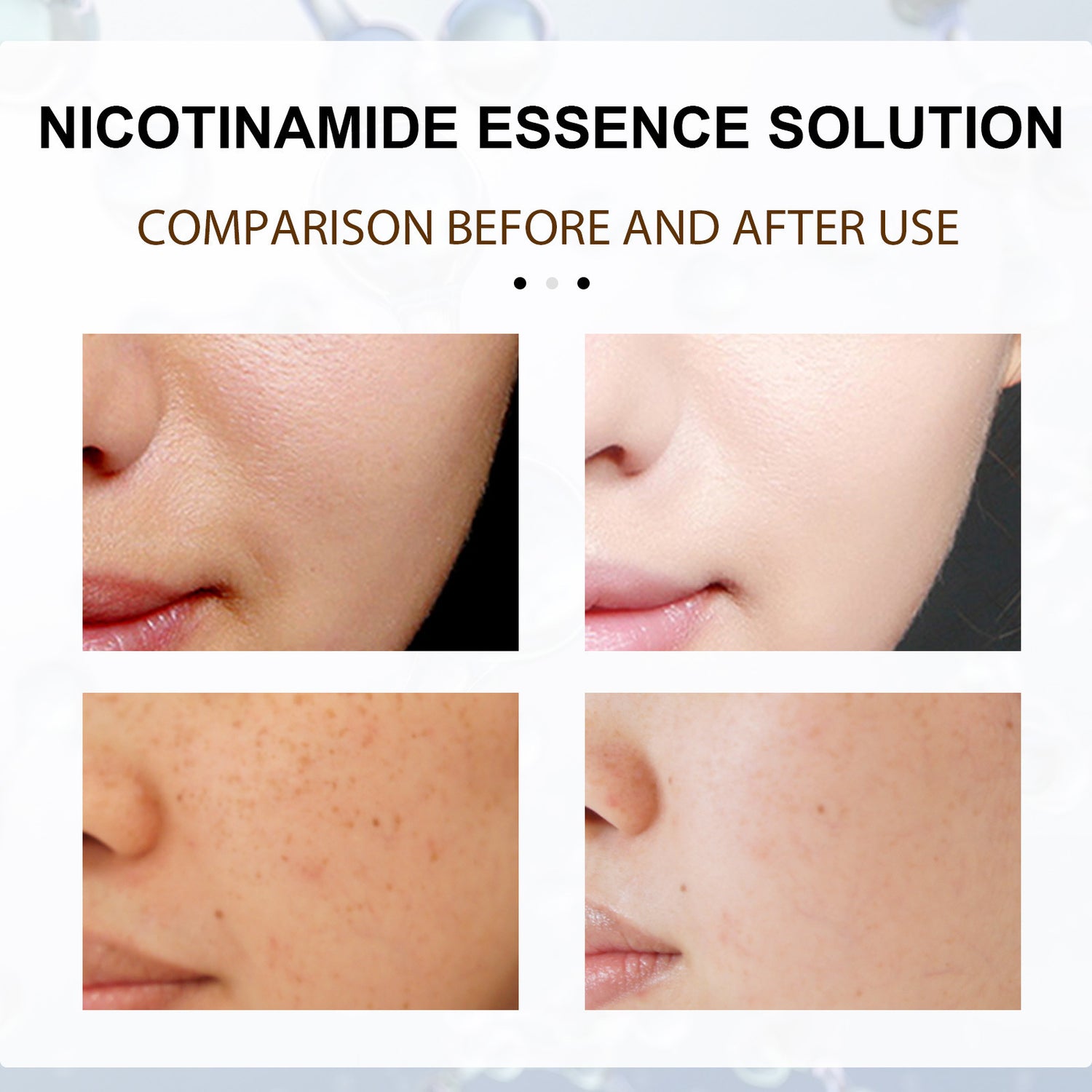 Fade Spots Shrink Pores Brighten Skin Color Hydrating Nicotinamide
