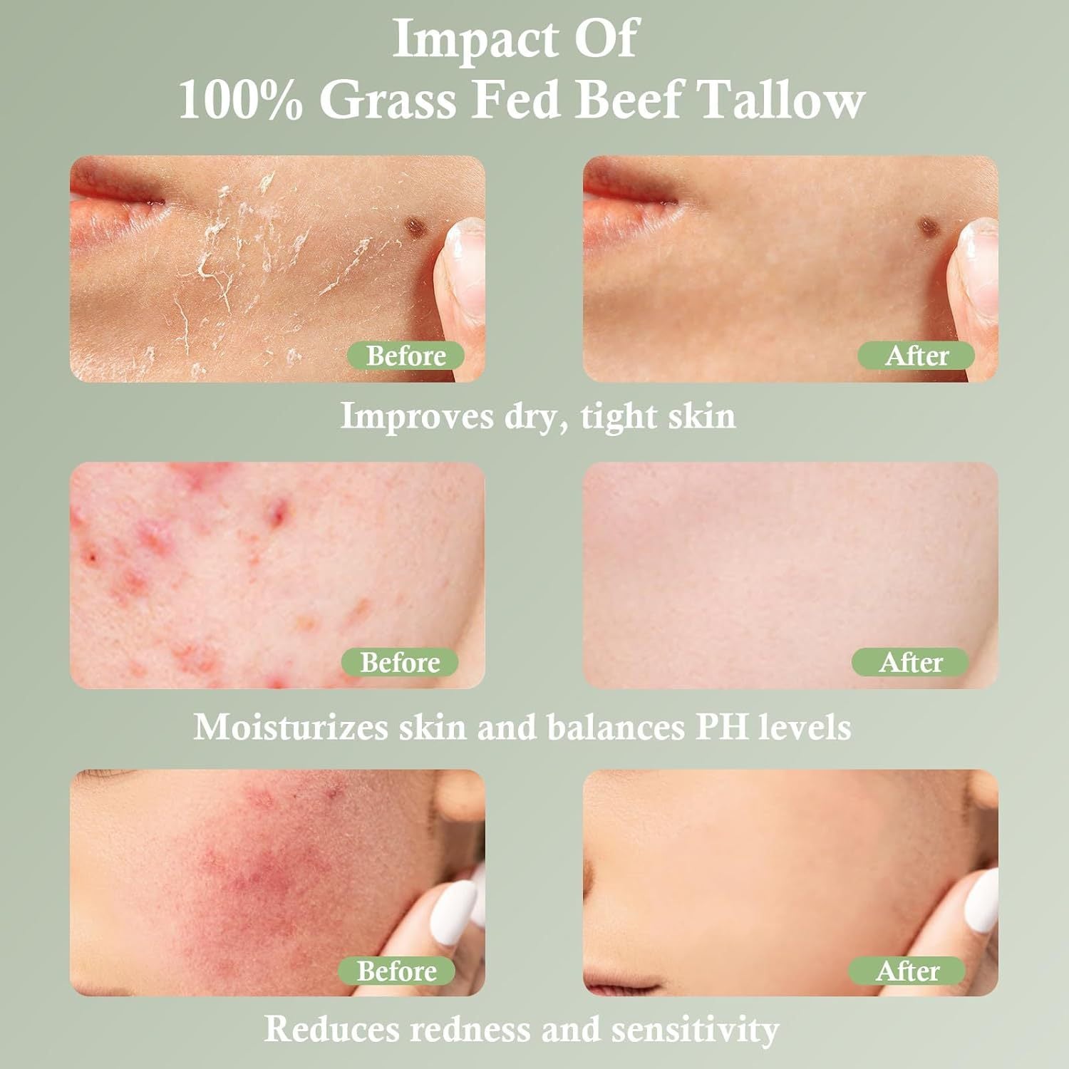 Tallow Skin Moisturizing Cream Grass-fed Tallow Soothing Nourishing Moisturizing Cream