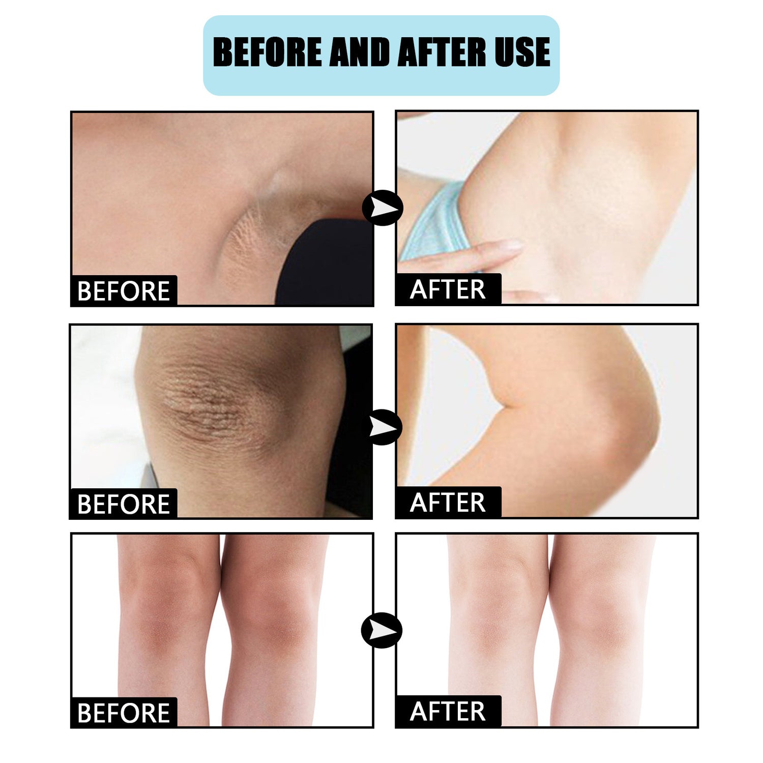 Underarm Moisturizing Brightening Beauty Cream