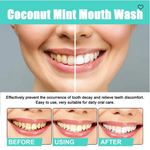 Coconut Mint Mouth Wash, Teeth Whitening Clean Breath Oral Care