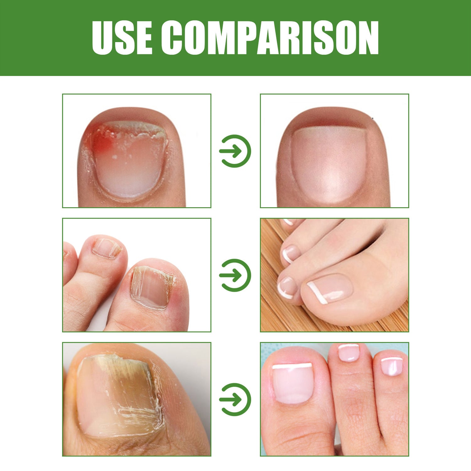 Nourishing Toe Nail Care