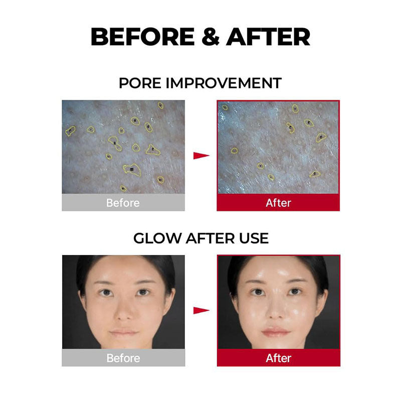 Brightening Skin Tightening Collagen Face Mask